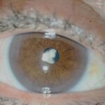 0.1-Lente-Multifocal-1024x683