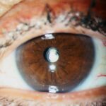 0.7.Lente-Multifocal-1024x683