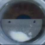 10.SEPARACION-INTERMEDIA