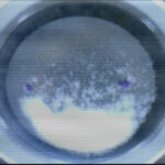 1p.Intralase-presbicia