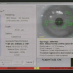 3p. Registro-de-iris-