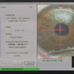 4-APLICACION-LASER