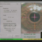 7.APLICACION-DEL-LASER-