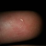 ANILLOS